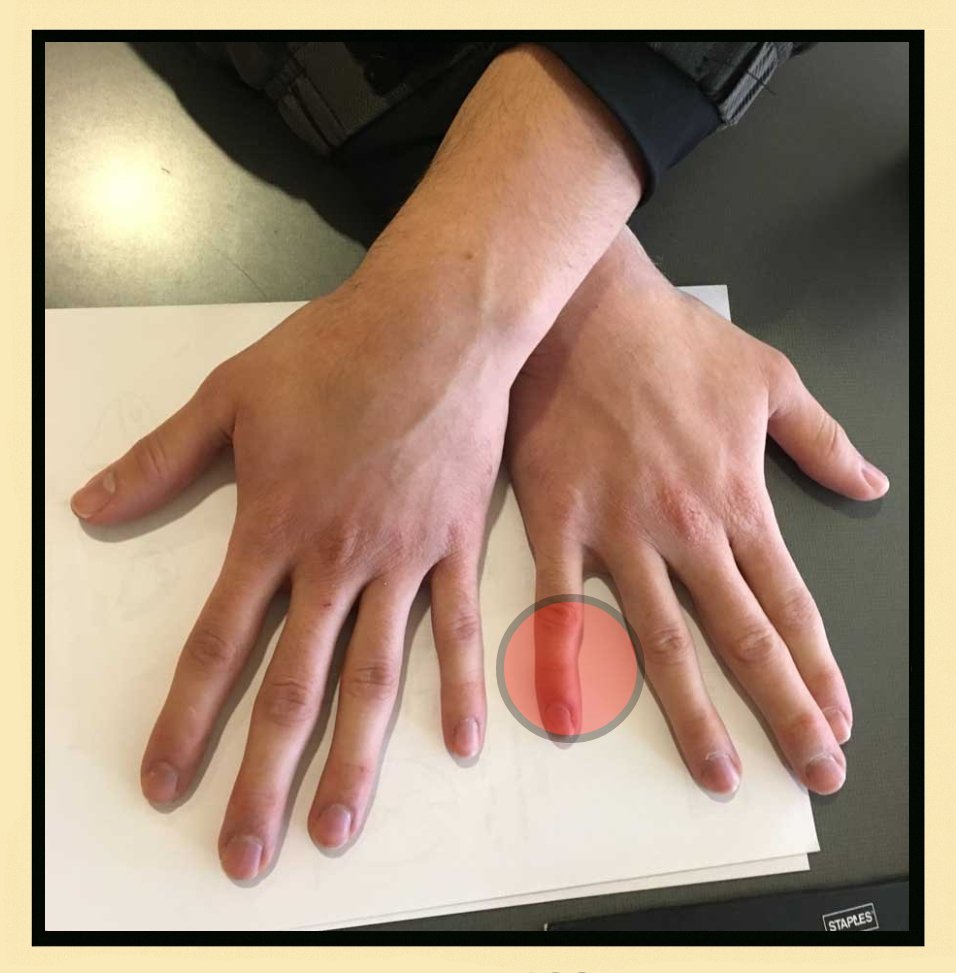 OrthoText Solution - Proper phone holding technique with OrthoText device