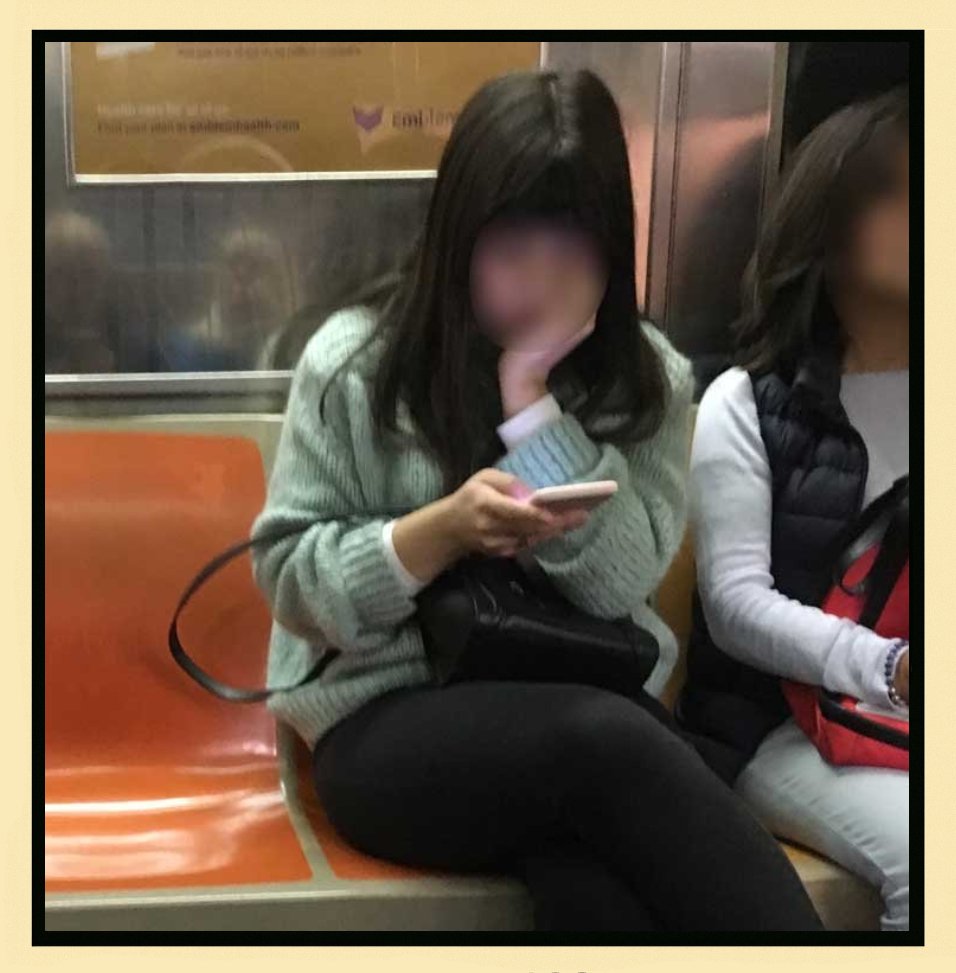 Text Neck Example 2 - Side view showing cervical spine curvature from phone use